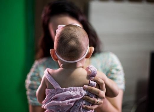 브라질에서 소두증 신생아 확진 사례는 2천33건이고 3천55건은 조사 중이다.