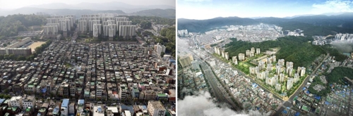성남 중1구역 재개발