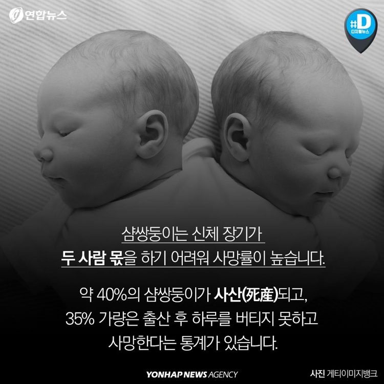[카드뉴스] 샴쌍둥이 출산 고집한 부모…이기적인 것일까요 - 8
