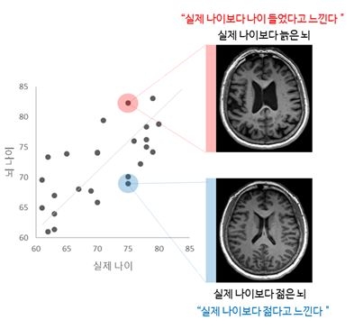 "'나는 젊다'고 느끼는 노인들, 실제 뇌 나이도 젊어" - 1