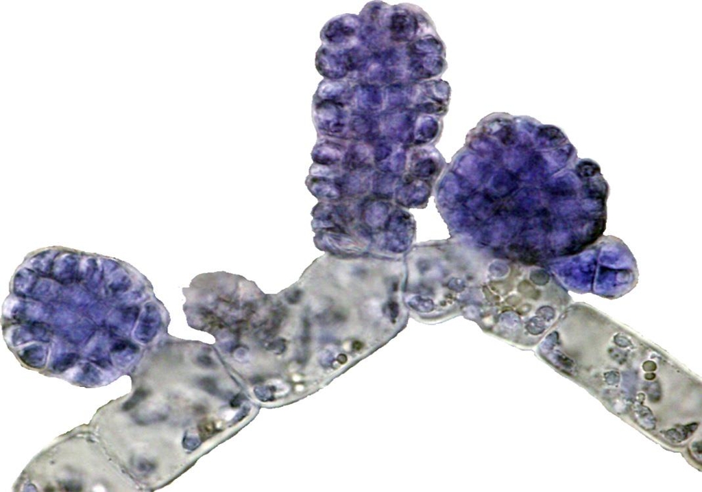 가지바다오디 현미경 사진