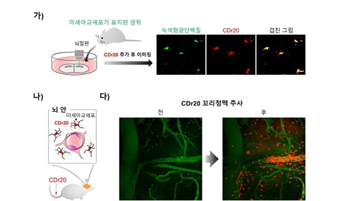 알츠하이머 동물모델 뇌의 미세 아교세포를 CDr20으로 관찰한 모습