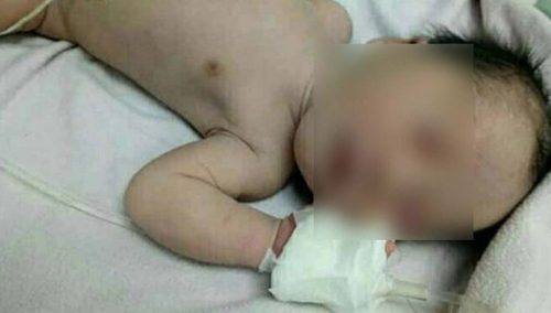 땅에 묻혀있다 극적으로 구조된 아기