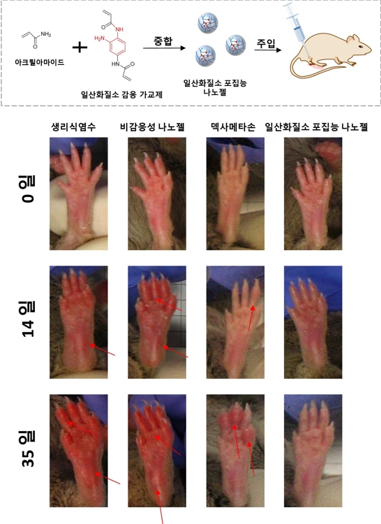 류머티즘 관절염 치료제 개발