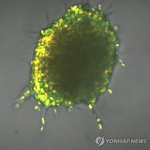 형광 바이오센서로 추적한 암세포 종양. 밝은 부위가 고에너지 소비 세포.