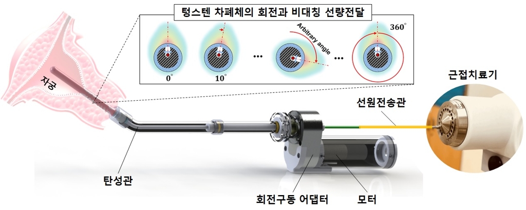 세기 조절 근접 방사선 치료 삽입기구 개념도