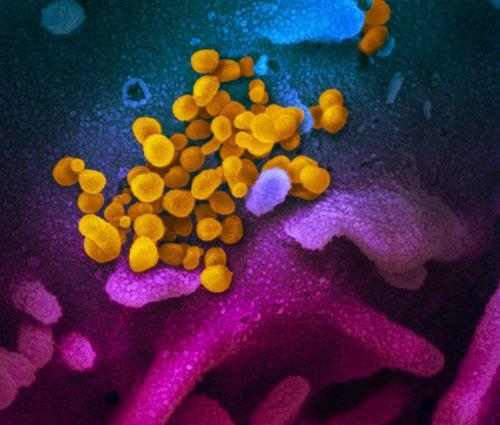 신종 코로나바이러스의 전자 현미경 영상. 신종 코로나바이러스(노란색)가 세포 표면(청색·분홍색)에 몰려 있다. 미국 확진자의 검체를 실험실에서 배양한 것이다. [미국 국립보건원(NIH) 알레르기 감염병 연구소 제공. 재판매 및 DB 금지]