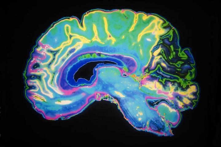 뇌 스캔 이미지