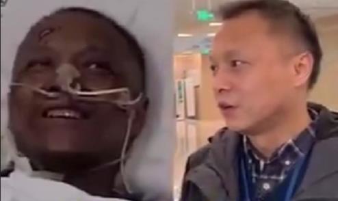 코로나19로 얼굴이 검게 변했던 중국인 의사 정상으로 회복
