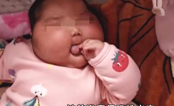 호르몬 함유된 유아용 크림 발라 얼굴이 부풀어 오른 중국 생후 5개월된 유아