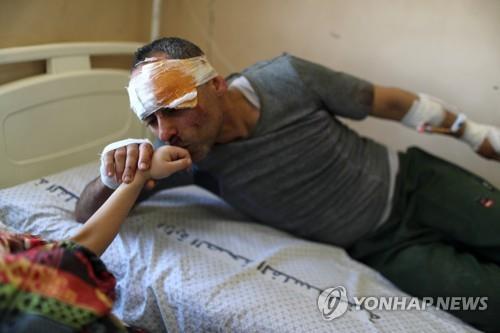 무너진 건물에서 구조된 팔레스타인 남성이 함께 구조된 딸의 손에 입을 맞추고 있다