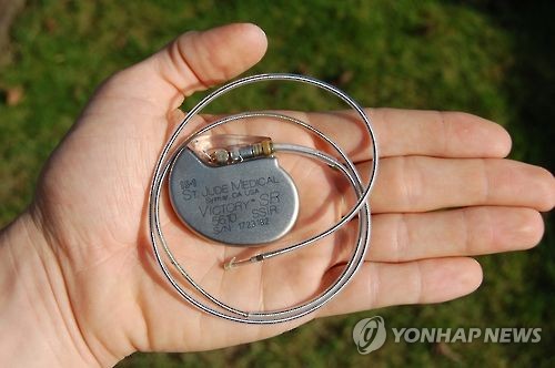 세인트주드의 인공 심장박동기