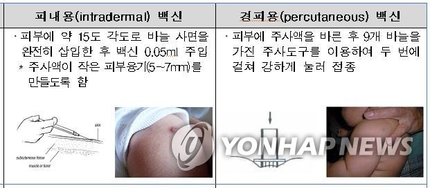 신생아용 결핵백신