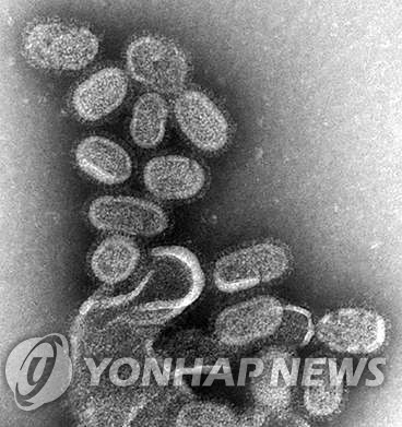 독감 바이러스 현미경