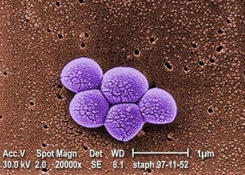 다제내성균 MRSA(메티실린 내성 황색포도상구균)를 2만 배 확대한 전자현미경 이미지