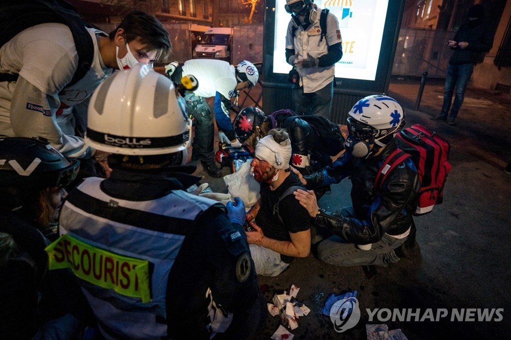 프랑스 보안법 반대 시위 현장을 취재하다 다친 사진기자