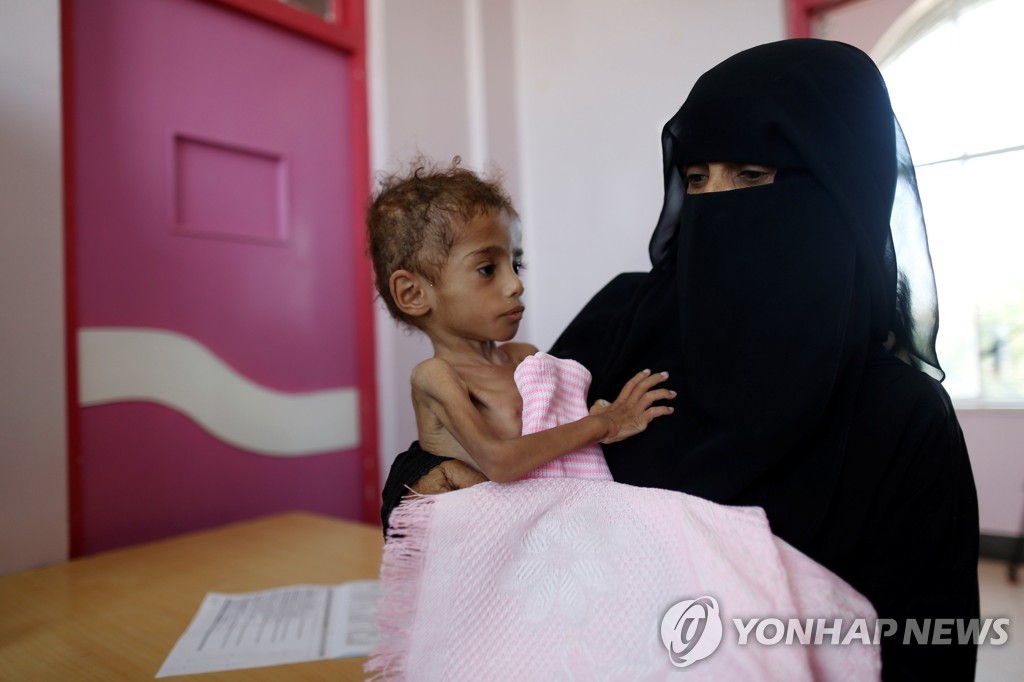 예멘은 지금 내전.사우디 봉쇄로 남녀노소 1천400만명 굶어죽을 위기