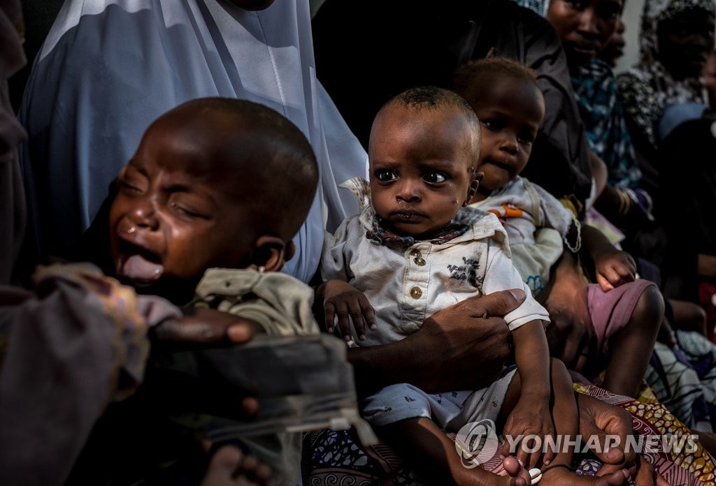 나이지리아 유니세프 보건소에서 어린이가 불안한 눈빛으로 자신의 검진 순서를 기다리고 있다. [유니세프 제공=연합뉴스]
