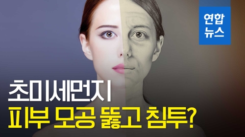 [영상] 초미세먼지 노출 많을수록 피부 주름도 악화