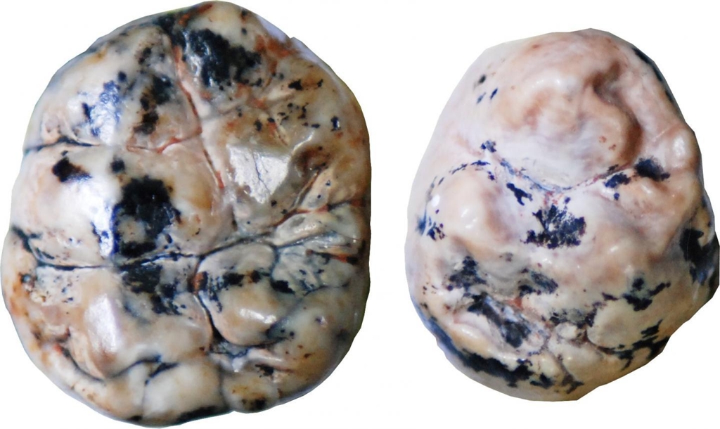 오스트랄로피테쿠스 아프리카누스(왼쪽)와 사람속 초기 조상의 치아