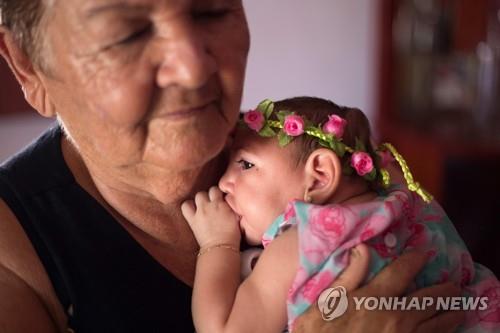 지카 바이러스에 따른 소두증 어린이