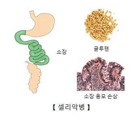"셀리악병 차단 항체 개발"
