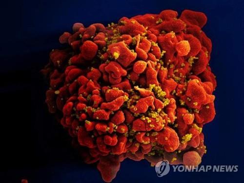 HIV에 걸린 인간의 백혈구 세포