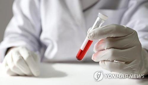 "코로나19 중환자 생사 예측 혈액 검사법 개발"