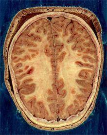뇌의 백질과 회색질