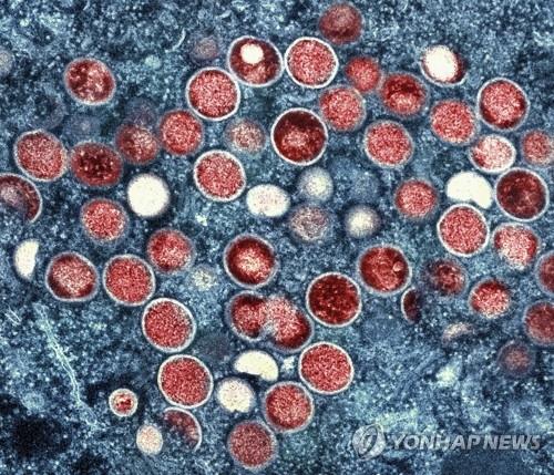 원숭이두창 바이러스 입자(붉은색) 전자현미경 이미지
