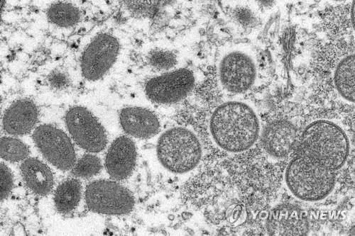 M두창(MPOX·옛 명칭 원숭이두창) 바이러스 입자