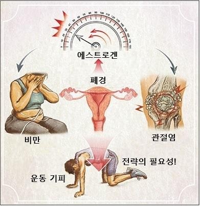 폐경기 질병의 위험과 운동의 필요성