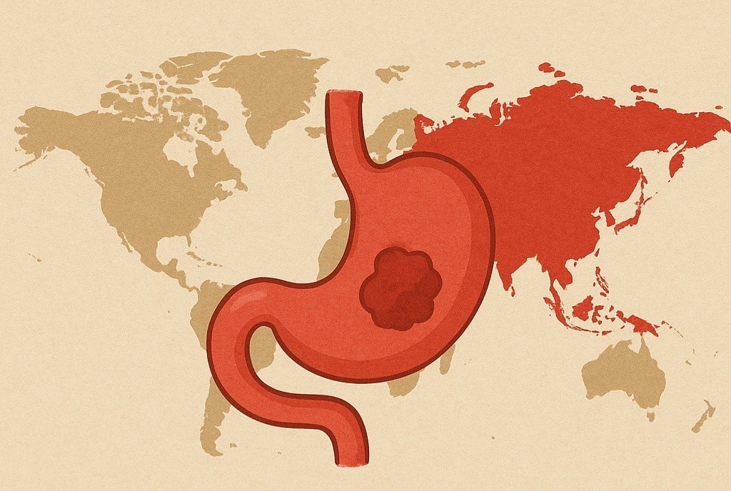 한중일, 위암 발병률이 높은 이유는? 연구 결과 밝혀낸 ‘위암 예방’에 가장 효과적인 식습관