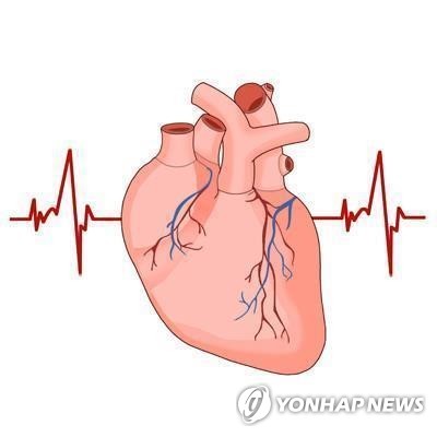 "뇌졸중 위험 큰 심방세동에 '리듬 조절 치료' 효과"