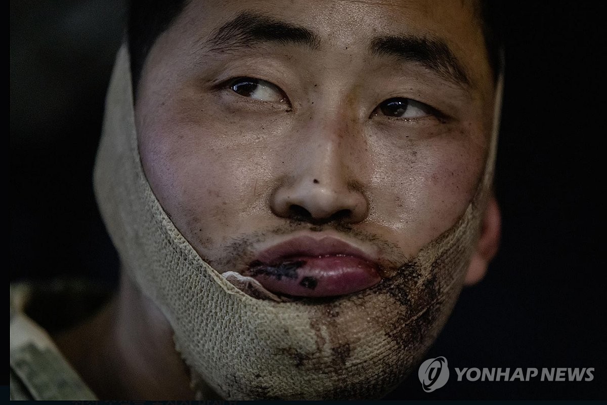 En esta foto se ve un soldado norcoreano herido, capturado por las fuerzas ucranianas en la región de Kursk occidental de Rusia, publicado en la cuenta X del presidente ucraniano Volodymyr Zelenskyy el 11 de enero de 2025 (hora local). (Foto no a la venta) (Yonhap)