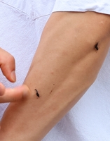Lovebug complaints